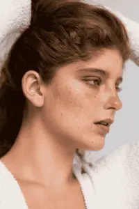home remedies for open pores